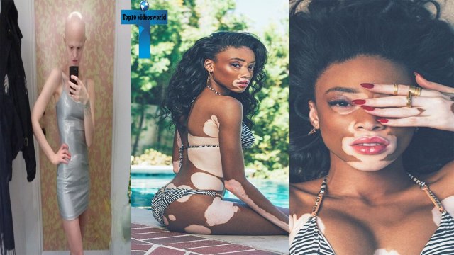 10 Unusual Models In The Fashion Industry - Most Unique Models Revolutionizing The Fashion World