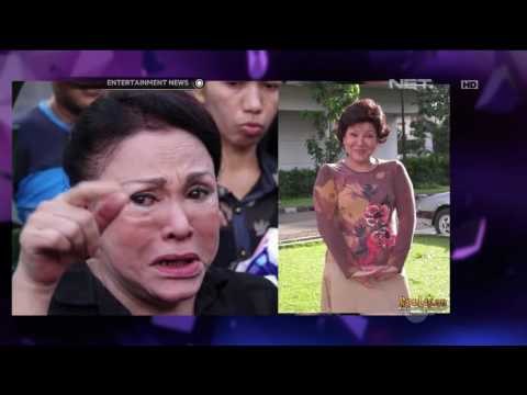 Sejumlah Selebriti Bicara Seputar Operasi Plastik