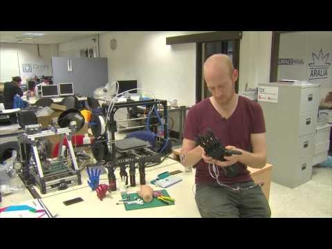 Lengan dan Kaki Palsu dengan Teknologi Cetak 3 Dimensi -NET5