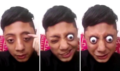 Kid Can Pop Out His Eyeballs