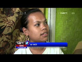 Bayi Perempuan Lahir Tanpa Tengkorak Depan - NET12