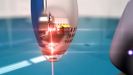 Clear + Brilliant® System MOA - Fractional Resurfacing