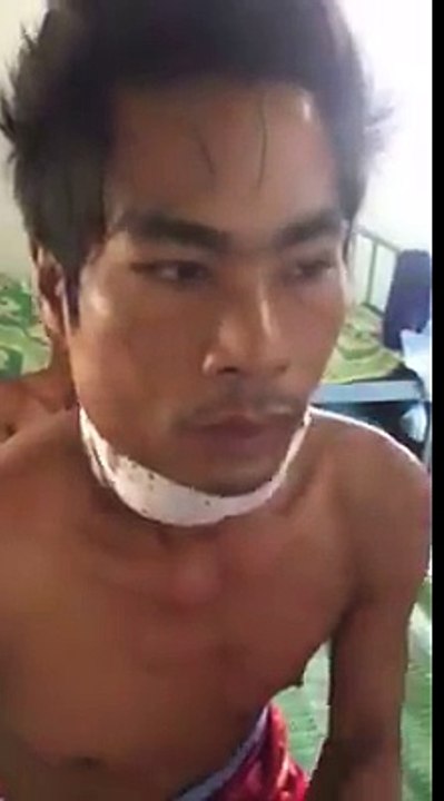 လယ္ပင္းက္ုိ လႊစက္နဲ႔ အတိုက္ခံလိုက္ရသည့္ အမ်ိဳးသား သို႔ေပမယ့္ ေသကံမေရာက္ အသက္မမေျပာက္ေျခ