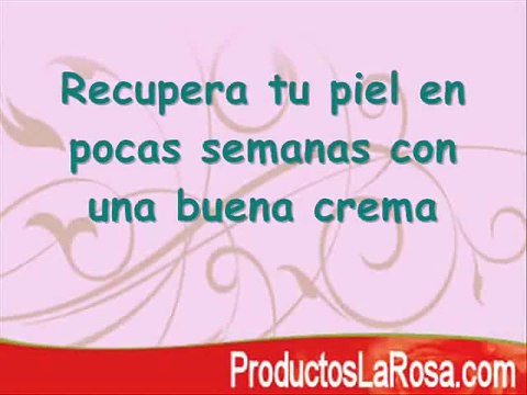 Crema para Las Estrias