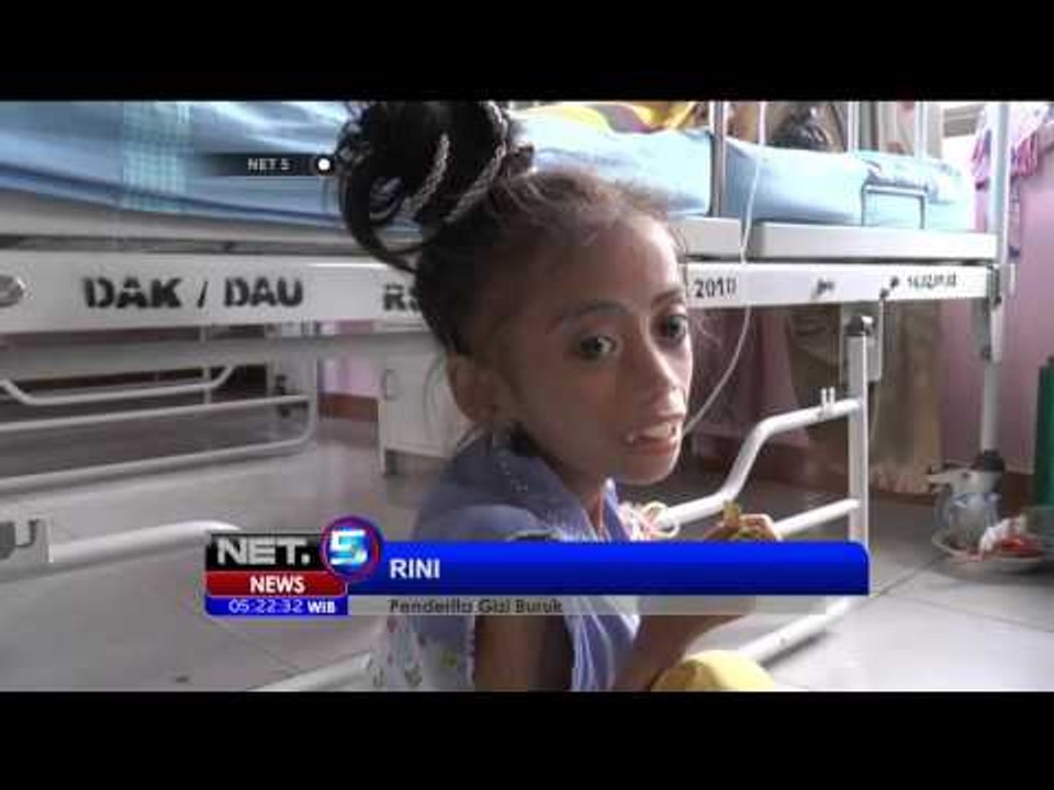 Kondisi Penderita Gizi Buruk di Makassar - NET5
