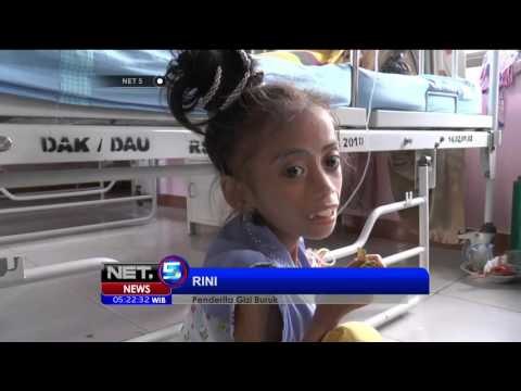 Kondisi Penderita Gizi Buruk di Makassar - NET5