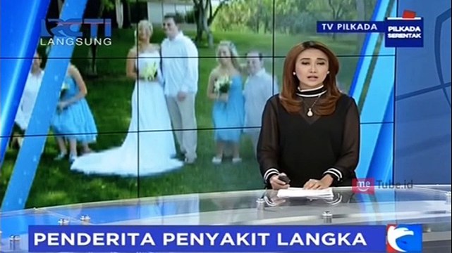 Kisah Pilu Gadis Penderita Penyakit Langka di Banjarnegara