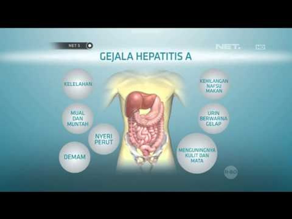 Agenda Khas Net5 :  Waspada Virus Hepatitis A Menyerang