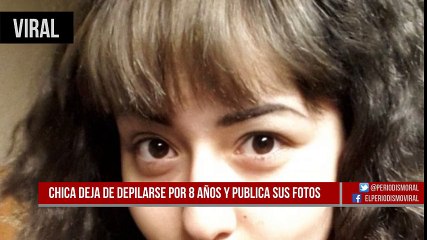 Elle a décidé de laisser pousser ses poils et elle a beaucoup de succès !