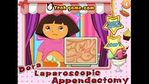 Dora laparoscopic appendectomy