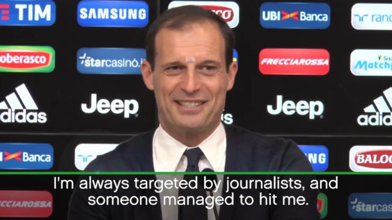 Allegri jokingly blames media for facial injury