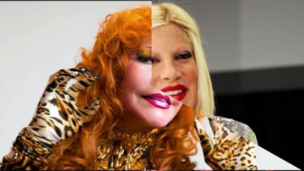 Celebridades ricas, talentosas y feas