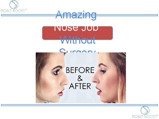 Amazing Nose Job Without Surgery - Nose Secret