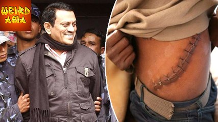 SCAM Doctor From India Who STOLE Kidneys | Event Asia