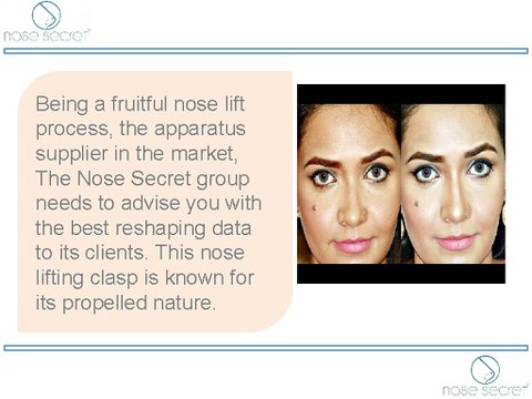 Nose Lift Without Surgery - Detailed Info by Nose Secret