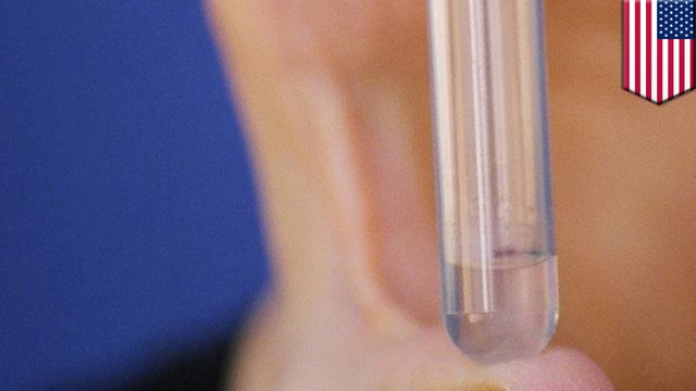 Male birth control: Contraceptive Vasalgel provides new birth control method