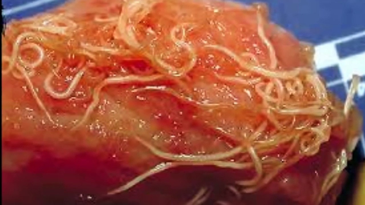 On comprend pourquoi elle avait de terribles douleurs au ventre... regardez ce qu'ils ont trouvé dedans