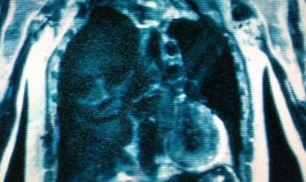 Abyzou (Lista Asesinos Villanos Antiheroes del cine)