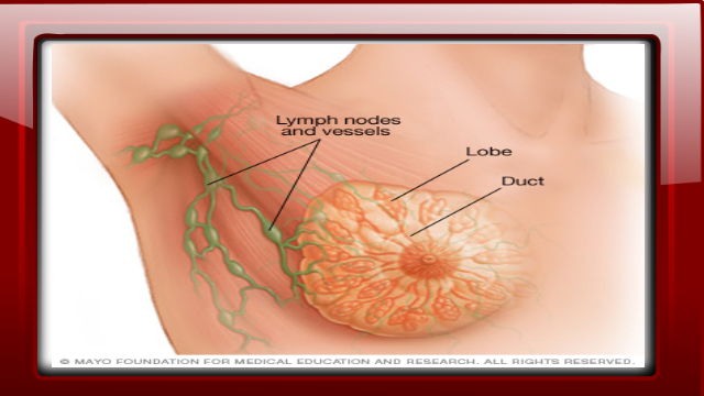 breast cancer icd 10