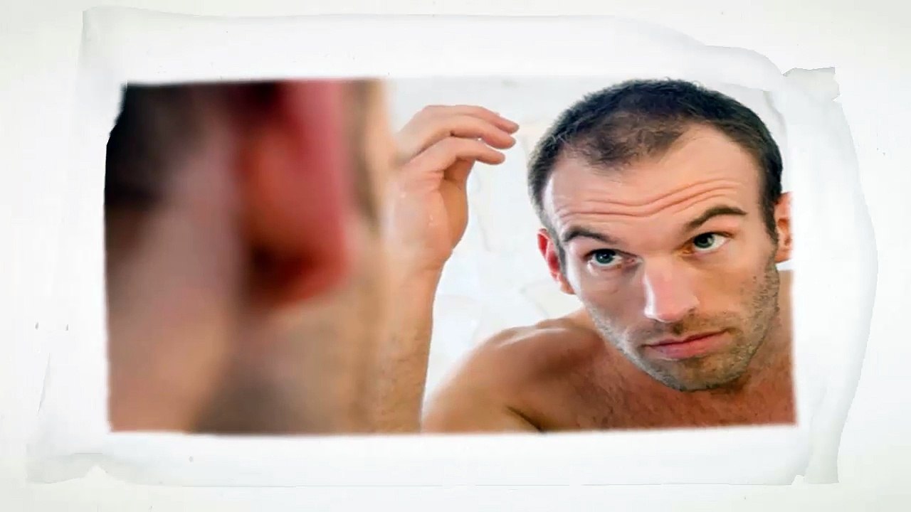 5 Common Cause of Hair Loss in Men
