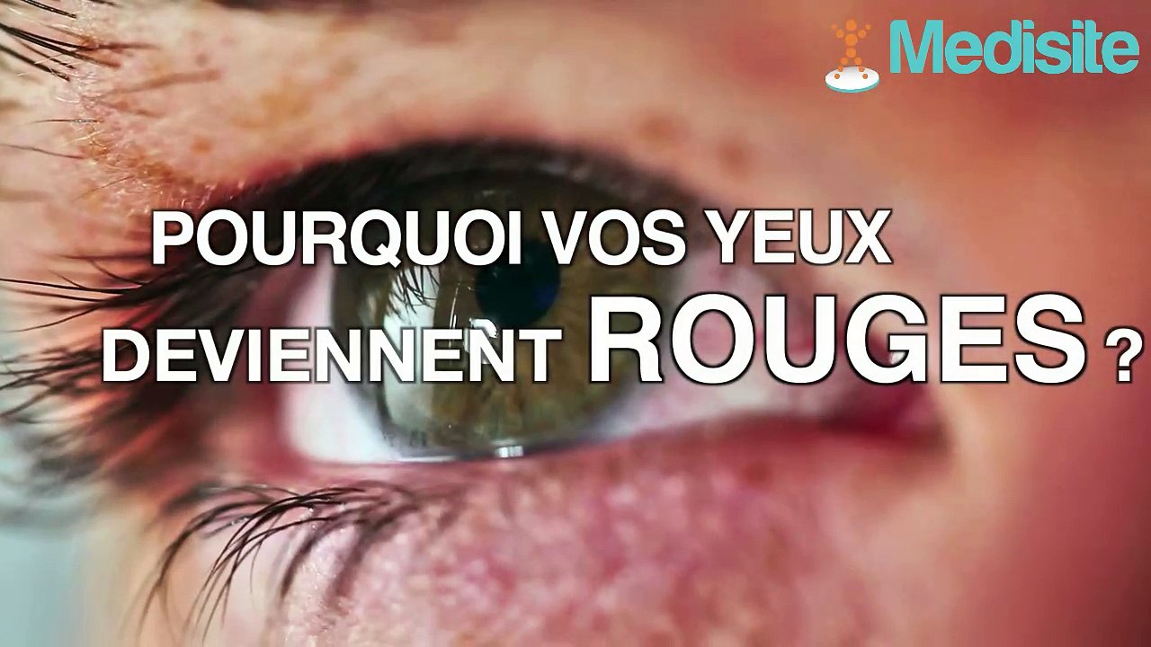 Pourquoi vos yeux deviennent rouges