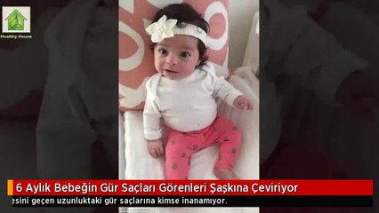 6 Aylık Bebeğin Gür Saçları Görenleri Şaşkına Çeviriyor