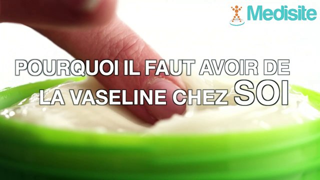 Pourquoi il faut avoir de la vaseline chez soi