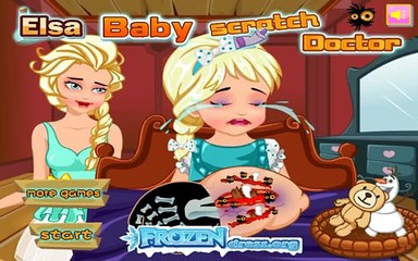 Elsa Baby Scratch Doctor - Baby Surgery Game - Doctor Game For Kids