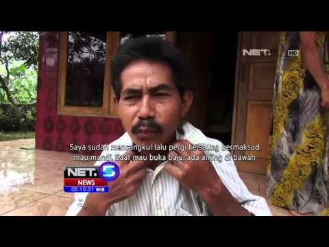 13 Warga Menjadi Korban Gigitan Anjing Rabies - NET5