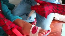 SPIDERMAN & FROZEN ELSA GOT HURT! NAIL IN FOOT! w/ Doctor vs JOKER in Real Life! Funny Superheroes