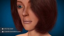 Gum Graft | Gingival Graft | Periodontal Plastic Surgery - 3D medical animation