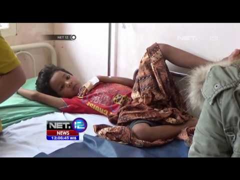 Konsumsi Ubi Kayu Goreng 1 Bocah di Padang Meninggal Dunia - NET12