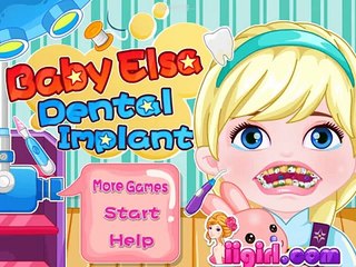 Baby Elsa Dental Implant - Disney princess Frozen - Best Baby Games For Girls
