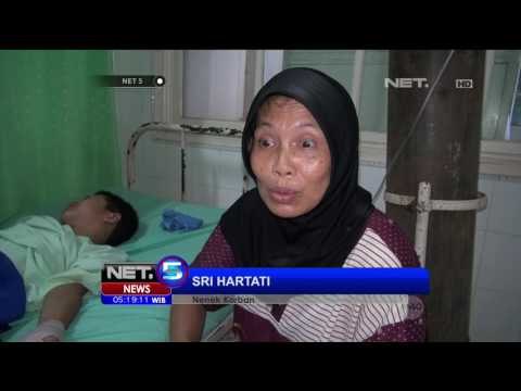 Ledakan Petasan Telan Korban Seorang Bocah Hingga Tanganya Diamputasi - NET5