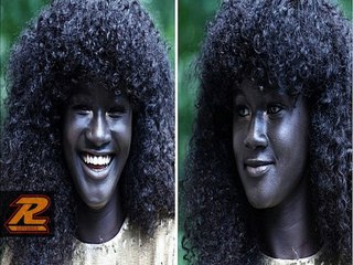 7 Gorgeous People with Unique Skin Color You Didn’t Know