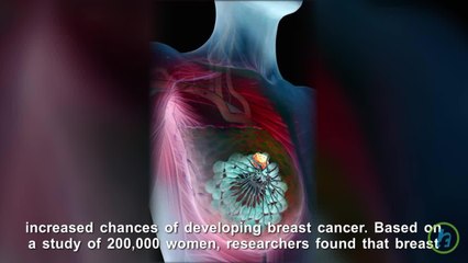 Breast Density Could Be Leading Indicator of Cancer Risk