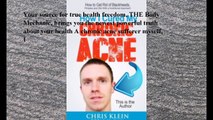 Download How I Cured My Chronic Acne: How to Get Rid of Blackheads, Pimples and Zits With a Nutritional Approach ebook P