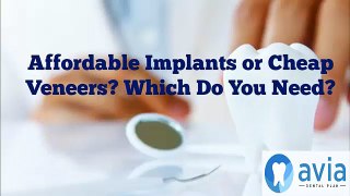 Affordable Implants or Cheap Veneers? Which Do You Need?