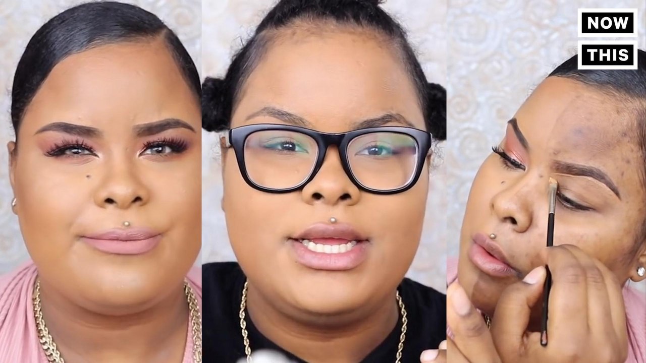YouTuber Overcomes Acne Scars