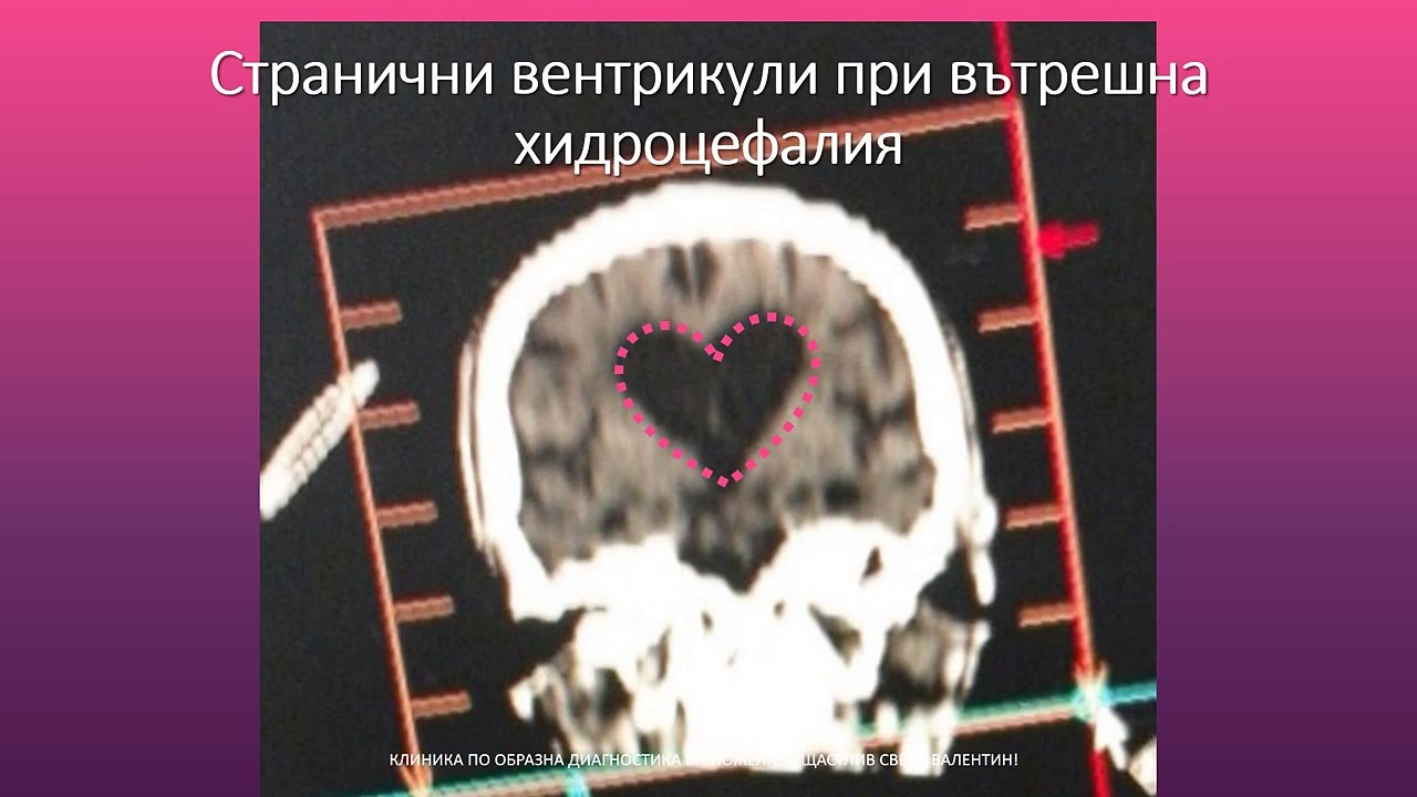 0:01 / 4:26