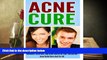 PDF [FREE] DOWNLOAD  Acne Cure: A Guide For Acne Treatment, Acne Removal, Acne Home Remedies, Acne
