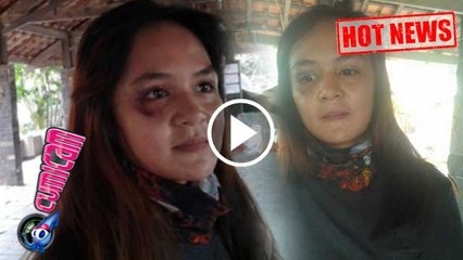 Wajah Istri Lebam, Andika 'Kangen Band' Bantah Lakukan KDRT - Cumicam 14 Februari 2017