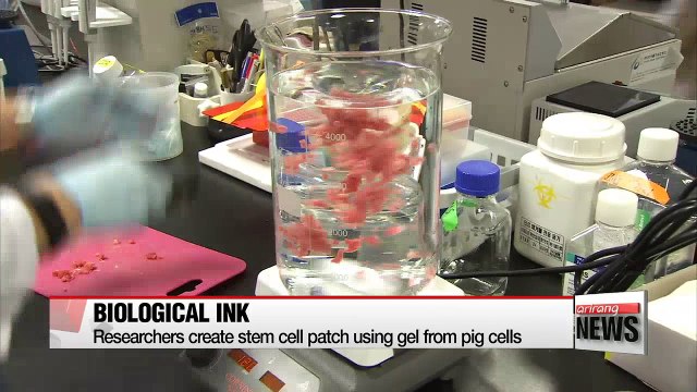 Korean researchers develop 3D-printed stem cell patch for heart patients