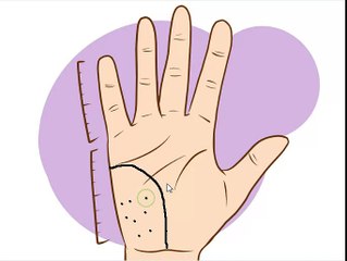 हथेली पर तिल होना कितना शुभ या अशुभ