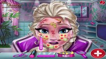 Frozen doctor game - princess baby elsa skin allergy - Doctor video games for kids