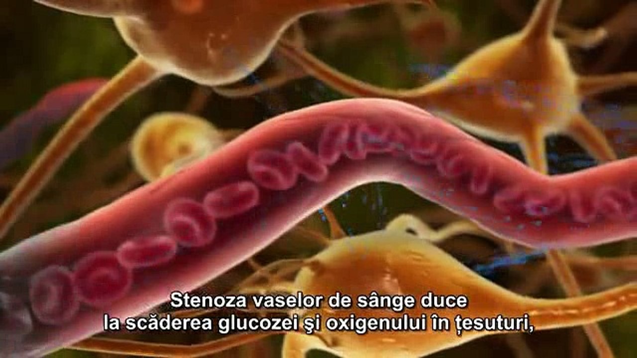 Actovegin Takeda Nycomed http://actovegin.wordpress.com/