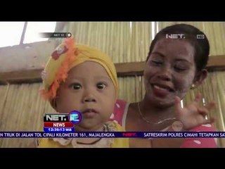 Lentera Indonesia - Ambulans Terapung Layani Pulau Terpencil - NET 12