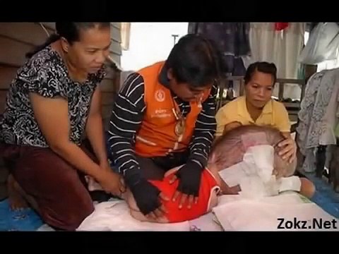 Человек с Самой большой головой в мире!