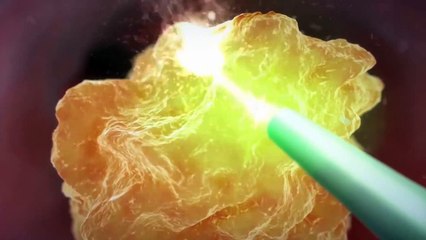 True Stone Dusting with Lumenis Pulse 120H