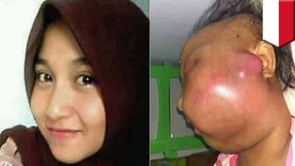 Teen girl dies from aggressive cancer after suspicious toothache